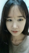 It's already been a year since I had the surgery~ — Korea cost, reviews & before-after | MISOODA