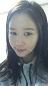 It's already been a year since I had the surgery~ — Korea cost, reviews & before-after | MISOODA