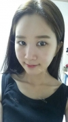 It's already been a year since I had the surgery~ — Korea cost, reviews & before-after | MISOODA