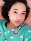 Ar + Zy + T + LP (jaw line) + thread lifting + (tack) Rhino (re) — Korea cost, reviews & before-after | MISOODA
