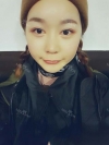 Ar + Zy + T / long hair + forehead / sil + epi + Rhino — Korea cost, reviews & before-after | MISOODA