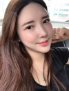 Ar + Zy + T + LP (jaw line) + thread lifting + (tack) Rhino (re) — Korea cost, reviews & before-after | MISOODA
