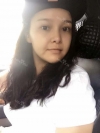 fg (forehead, zygoma), ni (fat), rhino (using donated cartilage and if more is needed ear cartilage) — Korea cost, reviews & before-after | MISOODA