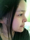 fg (forehead, zygoma), ni (fat), rhino (using donated cartilage and if more is needed ear cartilage) — Korea cost, reviews & before-after | MISOODA