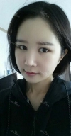 It's already been a year since I had the surgery~ — Korea cost, reviews & before-after | MISOODA