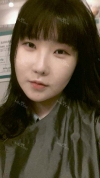 Ar + Zy (PPC) + T / adv + NI / ptosis + Rhino / lo #Free — Korea cost, reviews & before-after | MISOODA