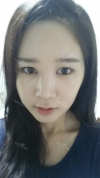 It's already been a year since I had the surgery~ — Korea cost, reviews & before-after | MISOODA