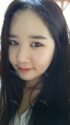 It's already been a year since I had the surgery~ — Korea cost, reviews & before-after | MISOODA