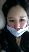 It's already been a year since I had the surgery~ — Korea cost, reviews & before-after | MISOODA