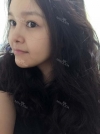 fg (forehead, zygoma), ni (fat), rhino (using donated cartilage and if more is needed ear cartilage) — Korea cost, reviews & before-after | MISOODA