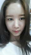 It's already been a year since I had the surgery~ — Korea cost, reviews & before-after | MISOODA