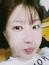 Ar + Zy (PPC) + T / adv + NI / ptosis + Rhino / lo #Free — Korea cost, reviews & before-after | MISOODA