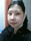 Ar + Zy (PPC) + T / adv + NI / ptosis + Rhino / lo #Free — Korea cost, reviews & before-after | MISOODA