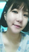 Ar + Zy (PPC) + T / adv + NI / ptosis + Rhino / lo #Free — Korea cost, reviews & before-after | MISOODA