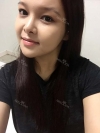 fg (forehead, zygoma), ni (fat), rhino (using donated cartilage and if more is needed ear cartilage) — Korea cost, reviews & before-after | MISOODA