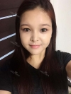 fg (forehead, zygoma), ni (fat), rhino (using donated cartilage and if more is needed ear cartilage) — Korea cost, reviews & before-after | MISOODA