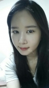 It's already been a year since I had the surgery~ — Korea cost, reviews & before-after | MISOODA