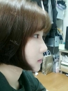 Ar + Zy (PPC) + T / adv + NI / ptosis + Rhino / lo #Free — Korea cost, reviews & before-after | MISOODA