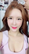 Ar + Zy + T + LP (jaw line) + thread lifting + (tack) Rhino (re) — Korea cost, reviews & before-after | MISOODA