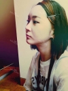 Ar + Zy + T / long hair + forehead / sil + epi + Rhino — Korea cost, reviews & before-after | MISOODA