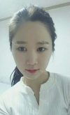 It's already been a year since I had the surgery~ — Korea cost, reviews & before-after | MISOODA