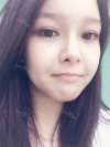 fg (forehead, zygoma), ni (fat), rhino (using donated cartilage and if more is needed ear cartilage) — Korea cost, reviews & before-after | MISOODA