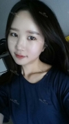 It's already been a year since I had the surgery~ — Korea cost, reviews & before-after | MISOODA