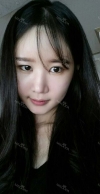 It's already been a year since I had the surgery~ — Korea cost, reviews & before-after | MISOODA