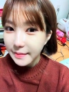 Ar + Zy (PPC) + T / adv + NI / ptosis + Rhino / lo #Free — Korea cost, reviews & before-after | MISOODA