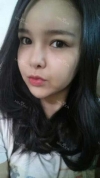 fg (forehead, zygoma), ni (fat), rhino (using donated cartilage and if more is needed ear cartilage) — Korea cost, reviews & before-after | MISOODA