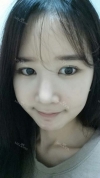 It's already been a year since I had the surgery~ — Korea cost, reviews & before-after | MISOODA