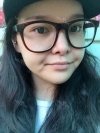 fg (forehead, zygoma), ni (fat), rhino (using donated cartilage and if more is needed ear cartilage) — Korea cost, reviews & before-after | MISOODA