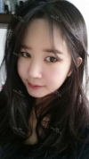 It's already been a year since I had the surgery~ — Korea cost, reviews & before-after | MISOODA