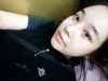 ar zy t (adv heading), fg (forehead), rhino (lo), pa (sil), aky ni (ptosis re), lat — Korea cost, reviews & before-after | MISOODA
