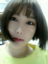 Ar + Zy (PPC) + T / adv + NI / ptosis + Rhino / lo #Free — Korea cost, reviews & before-after | MISOODA