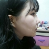 Ar + Zy (PPC) + T / adv + NI / ptosis + Rhino / lo #Free — Korea cost, reviews & before-after | MISOODA