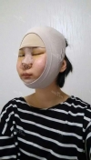 Ar + Zy + T / long hair + forehead / sil + epi + Rhino — Korea cost, reviews & before-after | MISOODA
