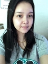 fg (forehead, zygoma), ni (fat), rhino (using donated cartilage and if more is needed ear cartilage) — Korea cost, reviews & before-after | MISOODA