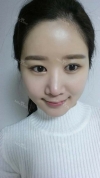 It's already been a year since I had the surgery~ — Korea cost, reviews & before-after | MISOODA