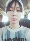 Ar + Zy + T / long hair + forehead / sil + epi + Rhino — Korea cost, reviews & before-after | MISOODA