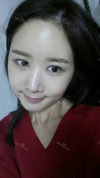 It's already been a year since I had the surgery~ — Korea cost, reviews & before-after | MISOODA