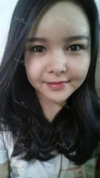 fg (forehead, zygoma), ni (fat), rhino (using donated cartilage and if more is needed ear cartilage) — Korea cost, reviews & before-after | MISOODA