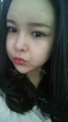 fg (forehead, zygoma), ni (fat), rhino (using donated cartilage and if more is needed ear cartilage) — Korea cost, reviews & before-after | MISOODA