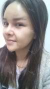 fg (forehead, zygoma), ni (fat), rhino (using donated cartilage and if more is needed ear cartilage) — Korea cost, reviews & before-after | MISOODA