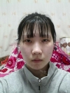 Ar + Zy (PPC) + T / adv + NI / ptosis + Rhino / lo #Free — Korea cost, reviews & before-after | MISOODA