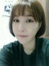 Ar + Zy (PPC) + T / adv + NI / ptosis + Rhino / lo #Free — Korea cost, reviews & before-after | MISOODA