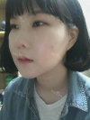 Ar + Zy (PPC) + T / adv + NI / ptosis + Rhino / lo #Free — Korea cost, reviews & before-after | MISOODA