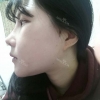 Ar + Zy (PPC) + T / adv + NI / ptosis + Rhino / lo #Free — Korea cost, reviews & before-after | MISOODA
