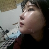 Ar + Zy (PPC) + T / adv + NI / ptosis + Rhino / lo #Free — Korea cost, reviews & before-after | MISOODA