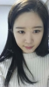 It's already been a year since I had the surgery~ — Korea cost, reviews & before-after | MISOODA